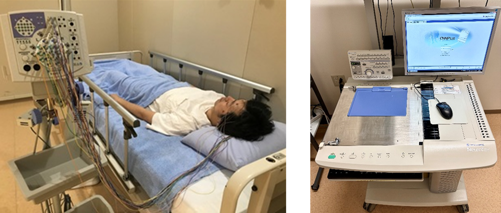 脳波検査