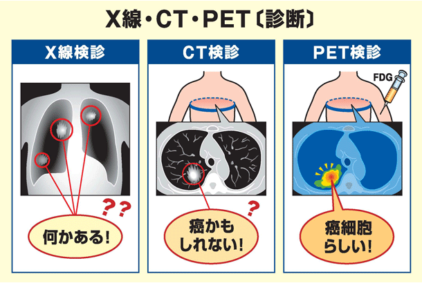 X線・CT・PET「診断」