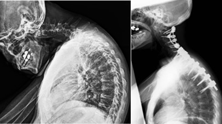 disease-01-12.png
